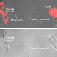 Images showing cells and tunnelling nanotube prior to and after mitochondrial transfer. After image has red coloring to show successful transfer.