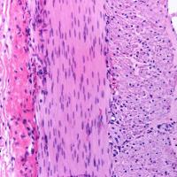 Microscope image of muscular layer of the small intestine with of two layers of smooth muscle fibers.