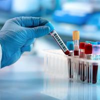 Image of a gloved hand holding a vial of blood in a lab setting.