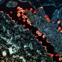 Transmission electron micrograph of HIV-1 virus particles (red/yellow) budding and replicating from a segment of a chronically infected H9 cell (blue/teal). 