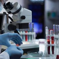 A scientist works with a microscope slide with a blood smear on it.