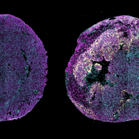 Microscope view of two newborn mouse hearts.