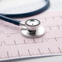 Image of blue Stethoscope on electrocardiogram chart paper.