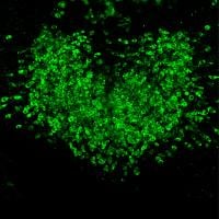 Fluorescence indicates heterogeneous calcium activity in hundreds of area postrema neurons 