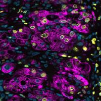 Microscope image of genetically engineered 3D liver cells. 