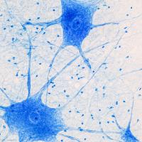 Motor neuron under the microscope.