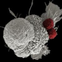  3d illustration of a pseudo-colored scanning electron micrograph of an oral squamous cancer cell (white) being attacked by two cytotoxic T cells (red). 