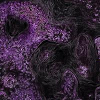 Microscopic image of a tumor in a mouse lung. 