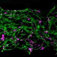 Magnification of an engineered bone marrow-on-a-chip includes a network of green-labeled blood vessels and patches of magenta-labeled cellular niches   