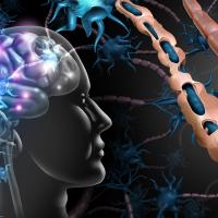 Depiction of deteriorating myelin sheaths in the brain
