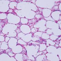 Histology image of human lung tissue