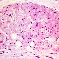 NIH, NIDDK, brown fat, white fat, heart disease, blood pressure, hypertension, diabetes, heart failure, cardiovascular disease, psychiatric disease, angiotensin blockers, losartan