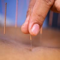 A close-up of fingers inserting an acupuncture needle into a person's skin.