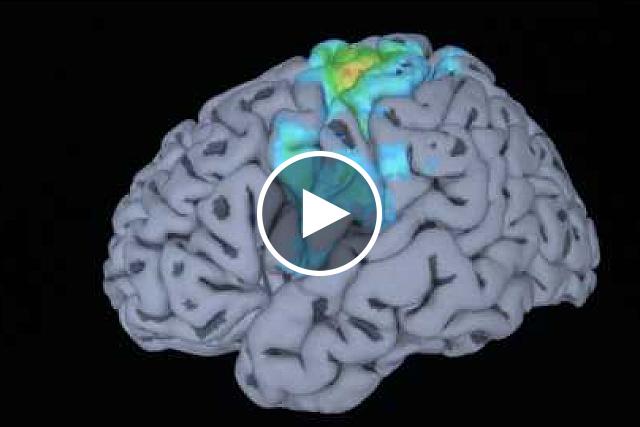 Renée Fleming's brain scan: understanding music and the mind