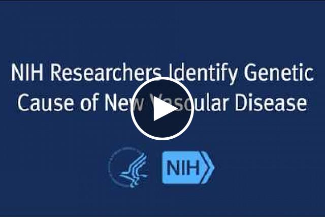 Clinical researchers at the National Institutes of Health’s Undiagnosed Diseases Program (UDP) have identified the genetic cause of a rare and debilitating vascular disorder not previously explained in the medical literature. The adult-onset condition is associated with progressive and painful arterial calcification affecting the lower extremities, yet spares patients’ coronary arteries.