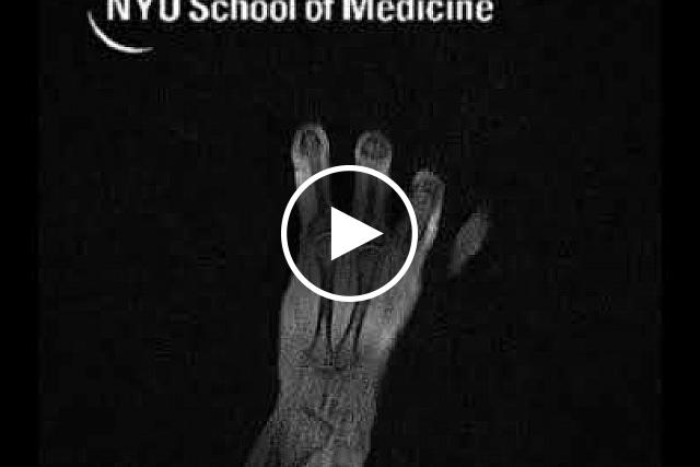 This video shows MRI of a moving hand.  