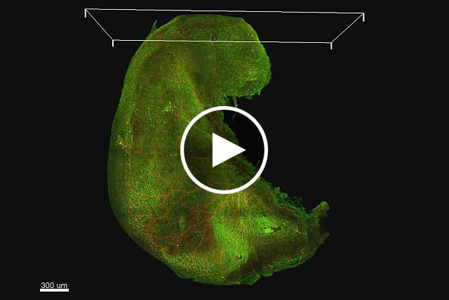 3D reconstruction of a mouse stomach. NIBIB