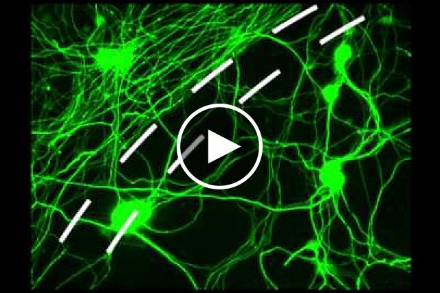 NIH-funded scientists developed a promising new drug that may lead to spinal cord injury treatments. Video courtesy of the NINDS and Silver lab, Case Western Reserve School of Medicine.