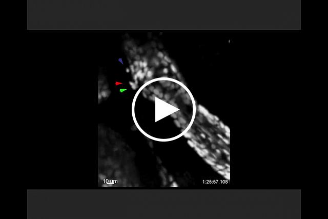 Four-hour time-lapse video shows the escape of stem cells, marked by arrows, from a hair follicle in an aging mouse. Some cells (red and green arrows) change the shape of their nuclei and squeeze through what are likely small openings in the follicle membrane before migrating away separately. Zhang et al, Nature Aging