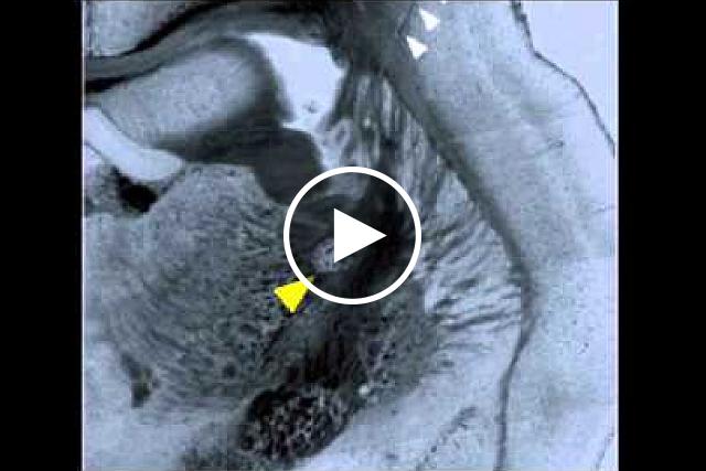 Scientists studied how just a few nerve cell in the mouse brain may control the switch between internal thoughts and external distractions. Using optogenetics, a technique that uses light-sensitive molecules to control nerve cell firing, the scientists were able to switch on and off drowsiness in mice. Video courtesy of the Halassa lab, NYU Langone Medical Center and NINDS.