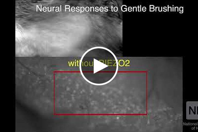 The Piezo2 gene may be responsible for tactile allodynia—the skin’s reaction to injuries, like sunburns, that makes normally gentle touches feel painful. Neurons lacking Piezo2 in a mouse’s skin did not respond to gentle brushing as did those with Piezo2. Courtesy of the Chesler lab, NCCIH.