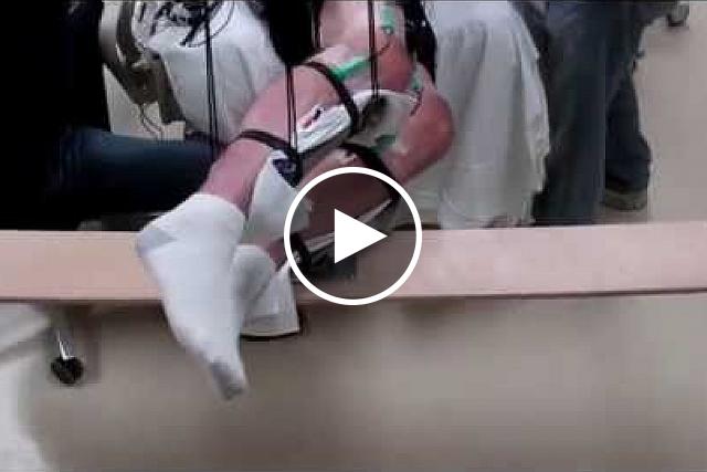 Video shows range of voluntary movement before and after treatment. The subject's legs are supported so that they can move without resistance from gravity. The electrodes are used to record muscle activity.
Edgerton laboratory/UCLA.