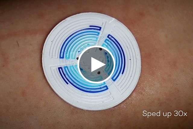 Time lapse footage of the Macroduct Sweat Collection System, or “sweat sticker,” filling with sweat. Northwestern University