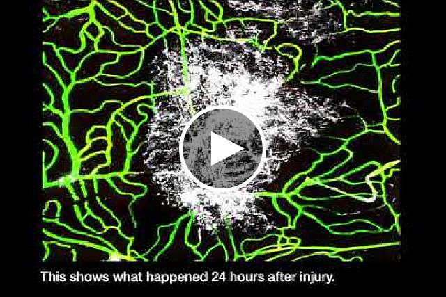 NIH researchers used state-of-the-art technology to examine how the brain’s lining heals after mild traumatic brain injury.