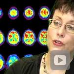 Alzheimer's Disease -- i on NIH -- episode #0016, segment 3
